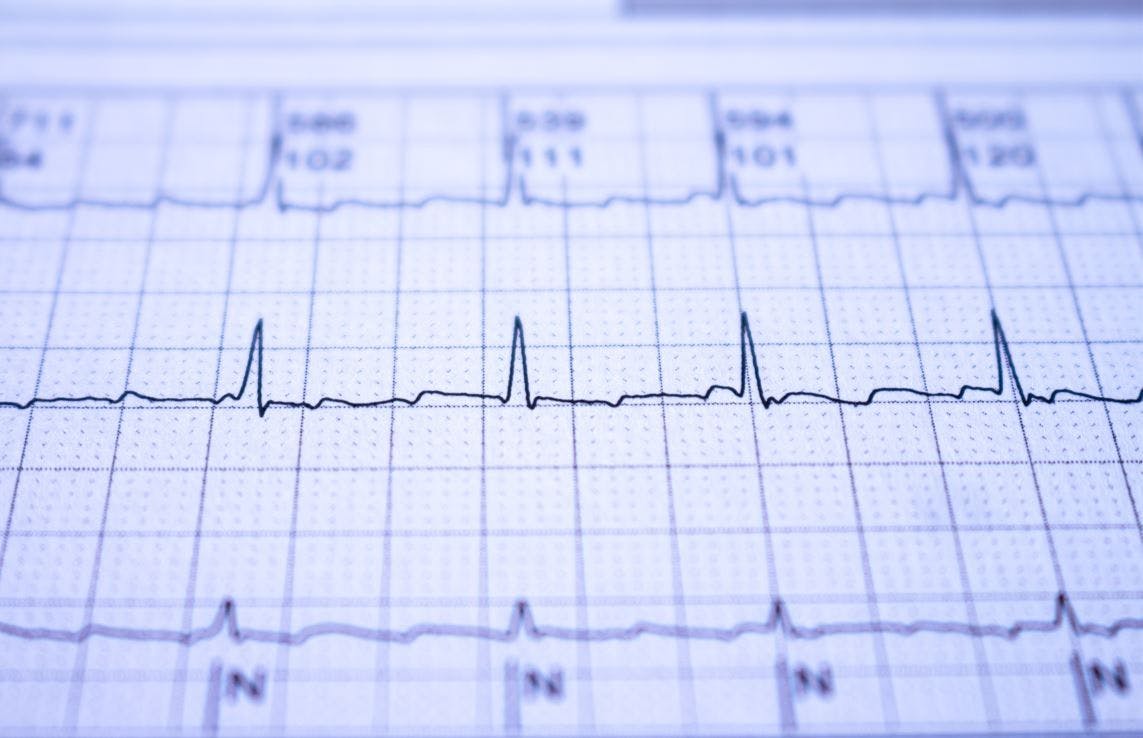 New Data Suggest Atrial Fibrillation May be More Common in Younger Adults than Previously Thought / Image credit: ©Horacio Selva/AdobeStock