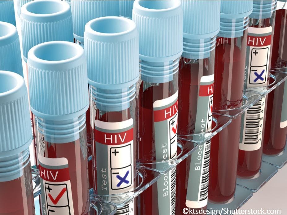 Image credit HIV blood test ©ktsdesign/Shutterstock.com