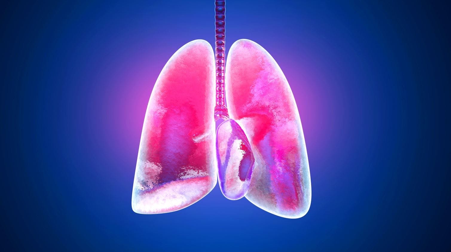 Albuterol budesonide combination reduces severe asthma exacerbations