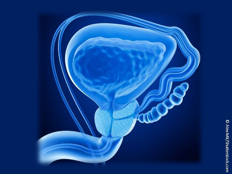 10 New Facts about Prostate Cancer 