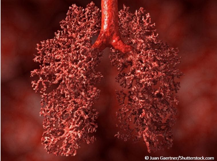 Indoor Heat, Air Quality Increase Symptoms in COPD