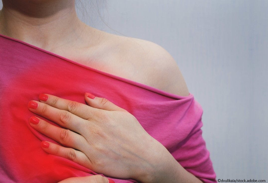 Study: Women at Higher Risk vs Men for Heart Failure or Death After First Heart Attack