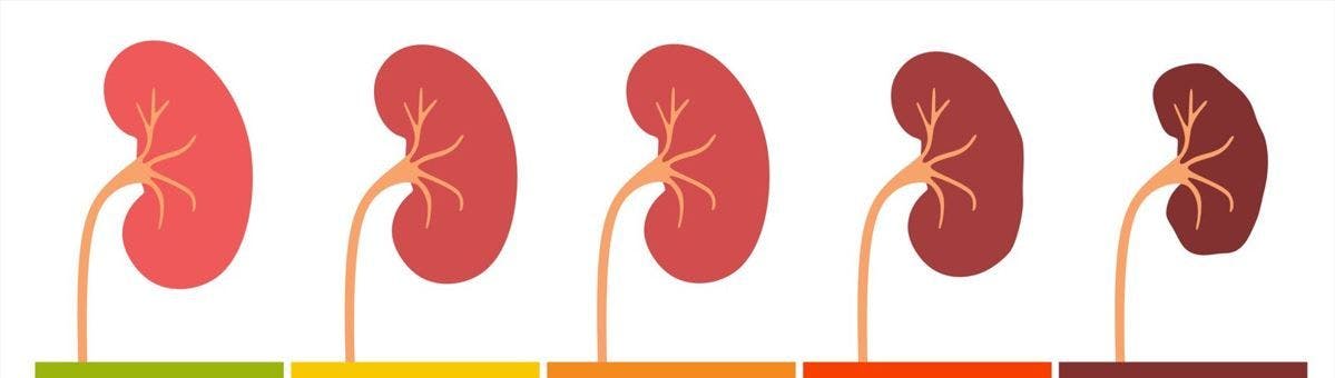 Rapid Progression of CKD Can Be Detected Early Using Simple Markers in Primary Care / Image credit kidney disease progression: ©pikovit/stock.adobe.com