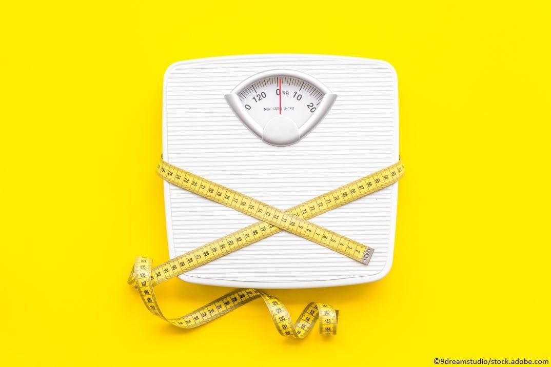 Weight Loss Shown to be Strongest Predictor of Type 2 Diabetes Remission
