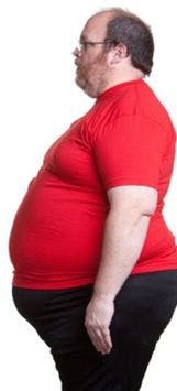 Obese Patients Unlikely to Return to Normal Weight