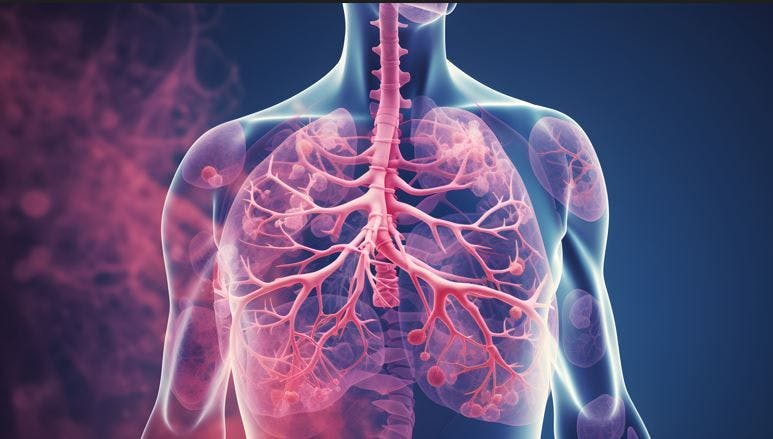 EPA, DHA May Have Protective Effects in Pulmonary Fibrosis / image credit lung fibrosis ©Vector Market generated with AI 