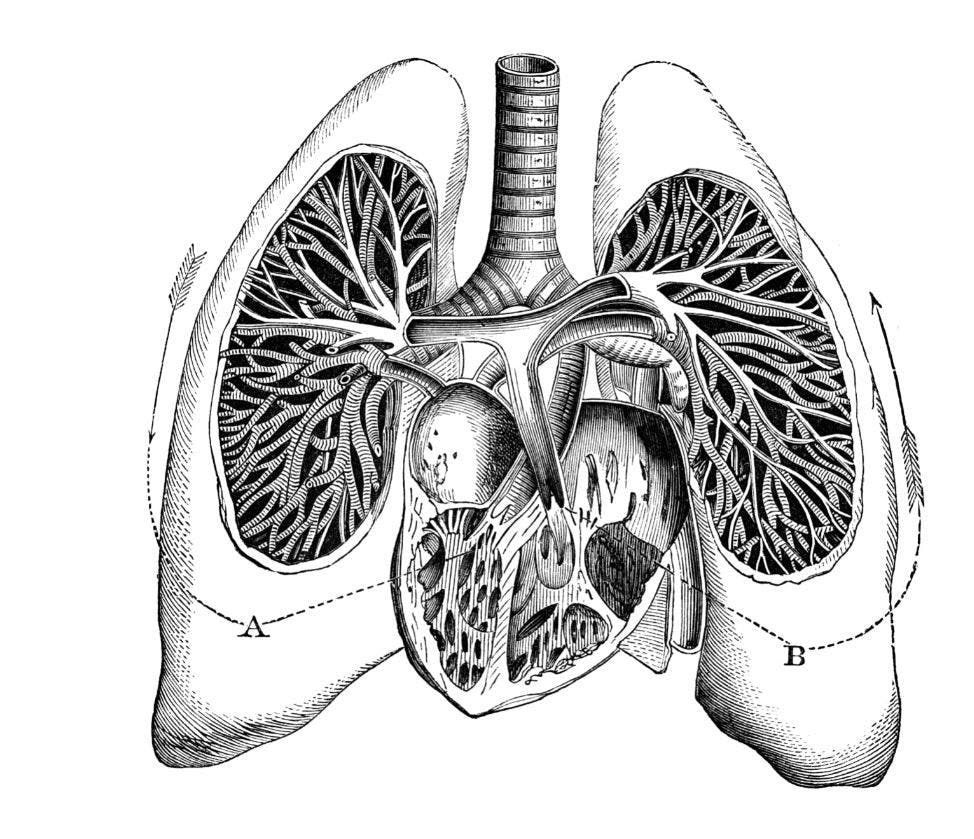 Patients with PAH-COPD May be at Higher Risk than those with Idiopathic PAH