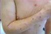 Skin Disorders Video 6: Itchy Skin