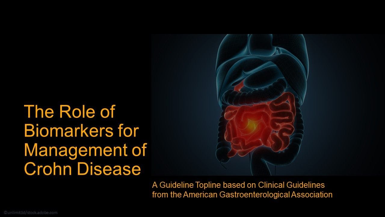 The Role of Biomarkers for Management of Crohn Disease: A Guideline Topline / image credit human intestines ©unlimit3d/stock.adobe.com