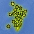 FluMist Not Effective Vs H1N1 (Maybe): What Next?
