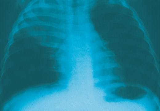Respiratory Disorders Part II: A Photo Essay