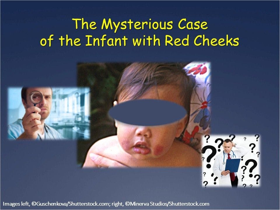 The Mysterious Case of the Infant with Red Cheeks 