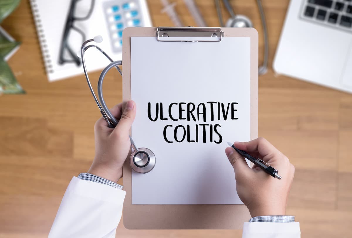 Survey Data Highlight Need for Education on Ulcerative Colitis Among Primary Care Clinicians / Image credit: ©onephoto/AdobeStock