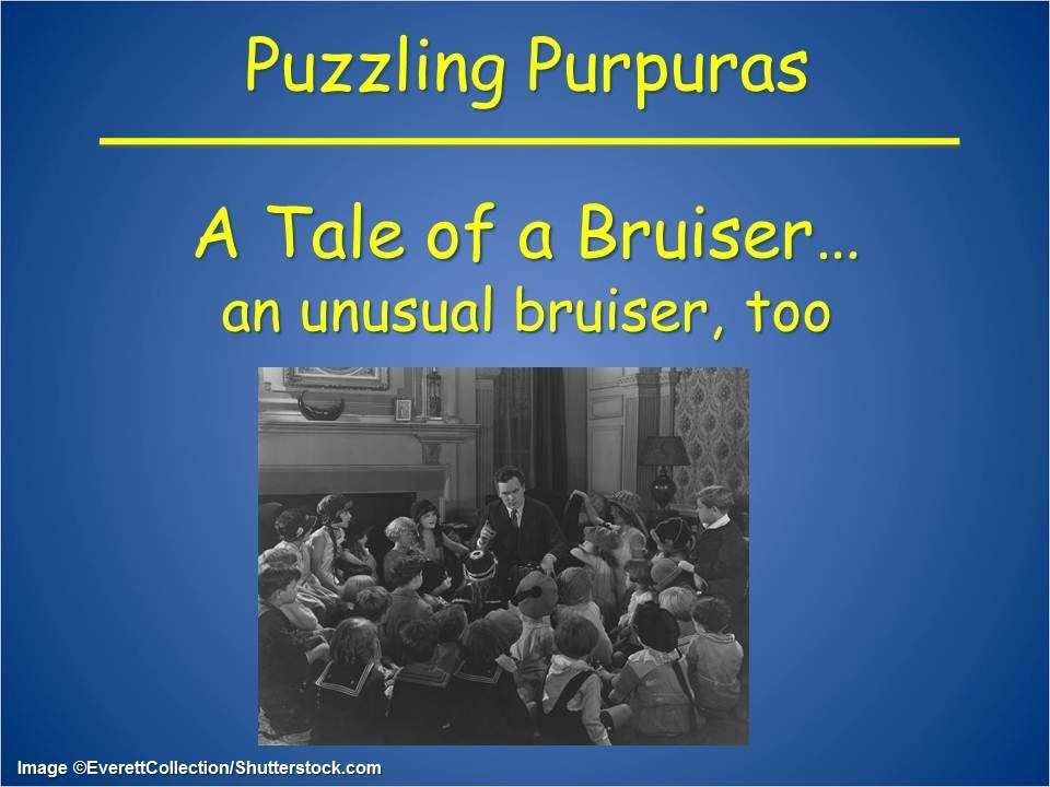Puzzling Purpuras: Tale of an Unusual Bruise 