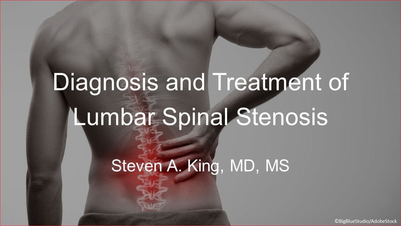 Diagnosis and Treatment of Lumbar Spinal Stenosis