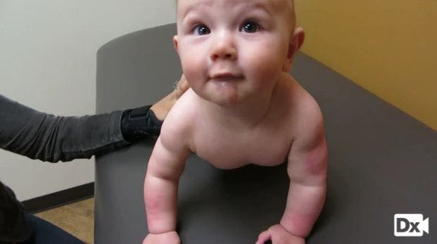Acute Widespread Rash in a 9-month-old Boy 