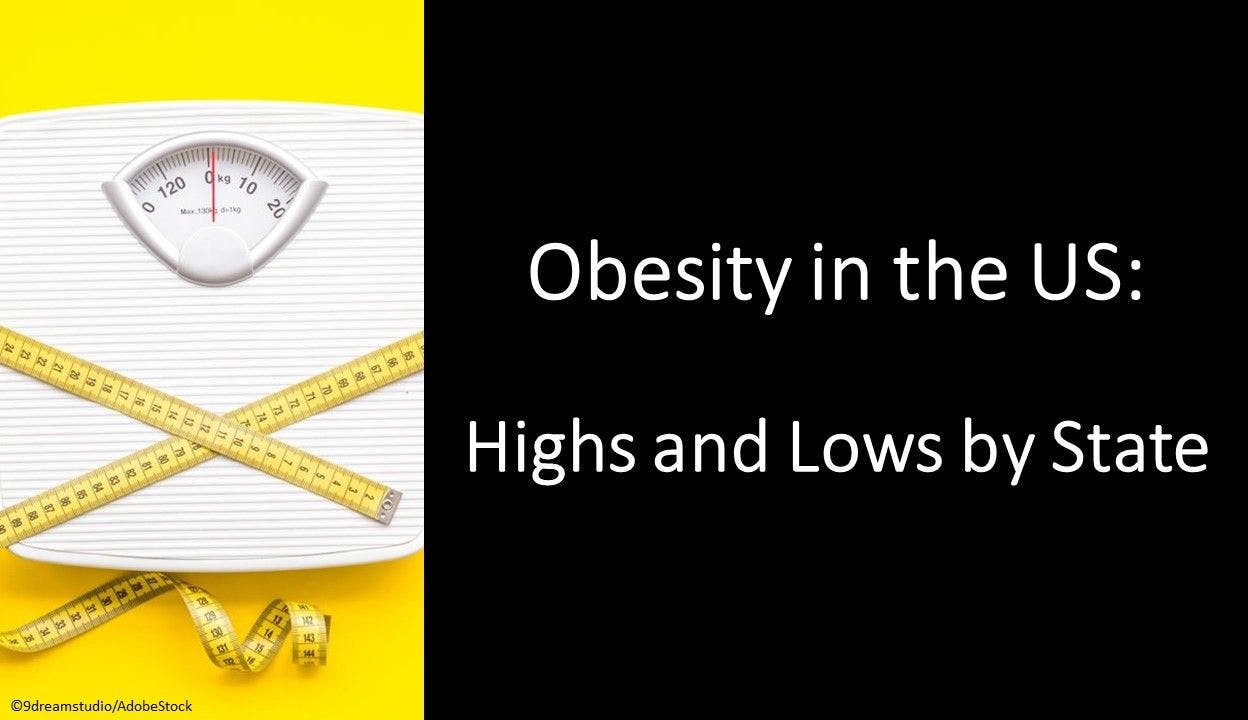 Obesity in the US: Highs and Lows by State