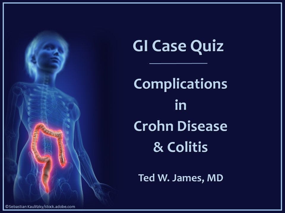 GI Case Quiz: Complications in Crohn Disease & Colitis 