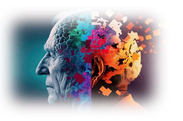 New Data on Alzheimer Disease Research from Biogen Planned for CTAD 2023 Meeting  / image credit ©Zerbor/stock.adobe.com