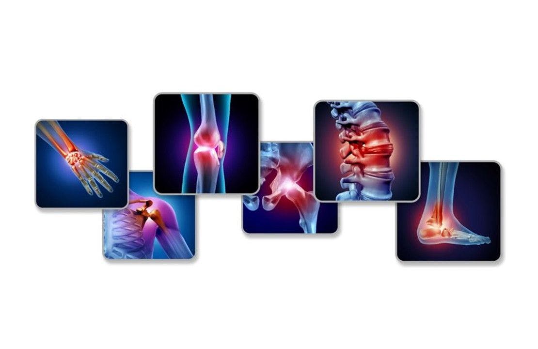 Pain management for inflammatory and osteoarthritis 
