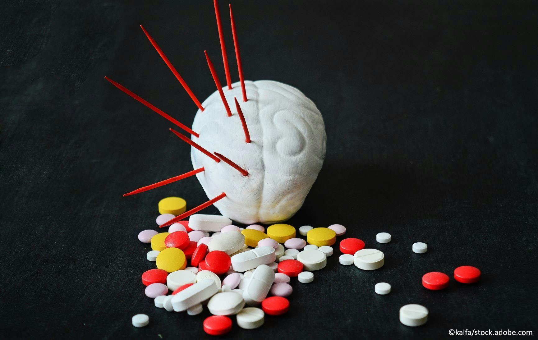 Primary Care Management of Headache: Part 2 / Image credit: ©kalfa/AdobeStock