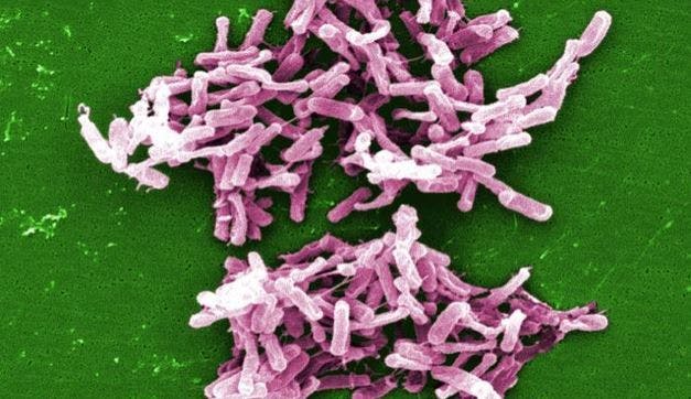 Fecal Microbiota Transplant Has a 90% Cure Rate: T/F?