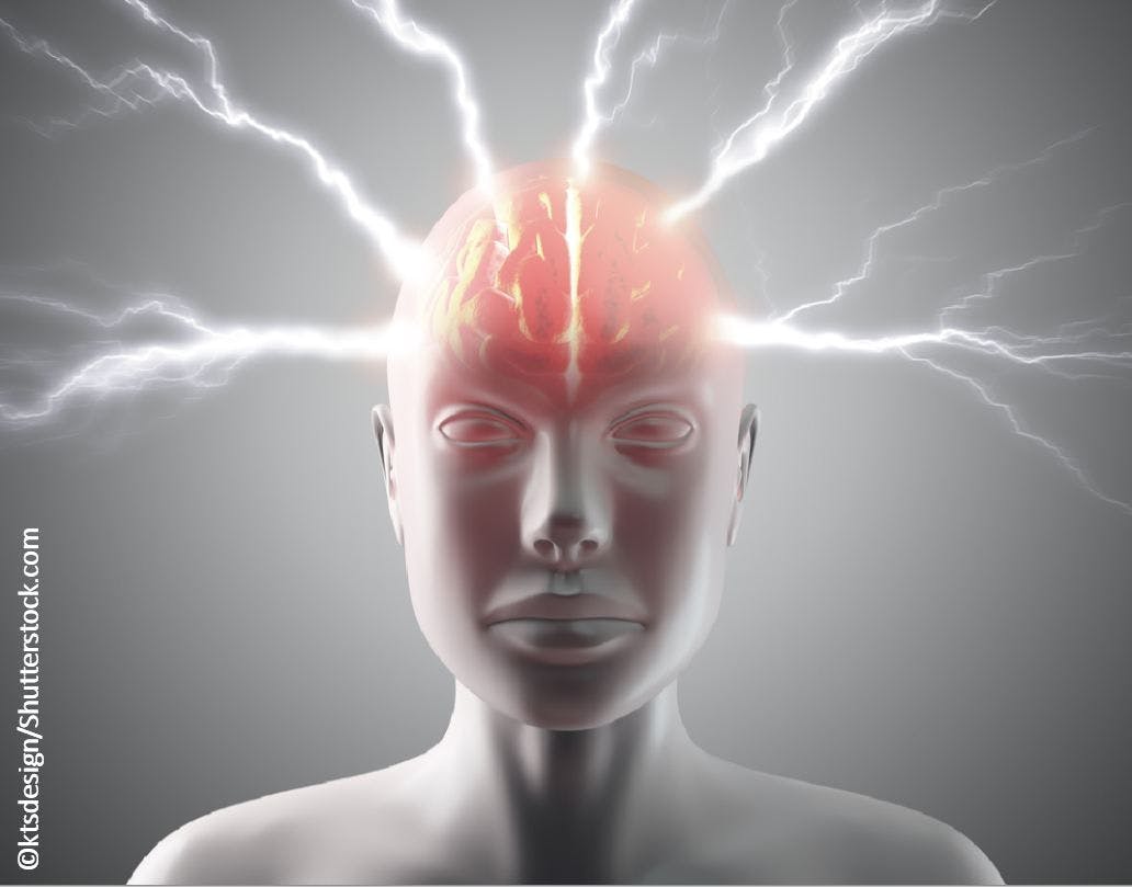 Migraine Meds: An 8-question Quiz