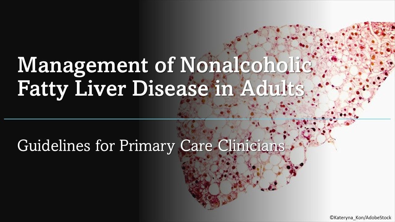 Management of Nonalcoholic Fatty Liver Disease in Adults: Guidelines for Primary Care Clinicians