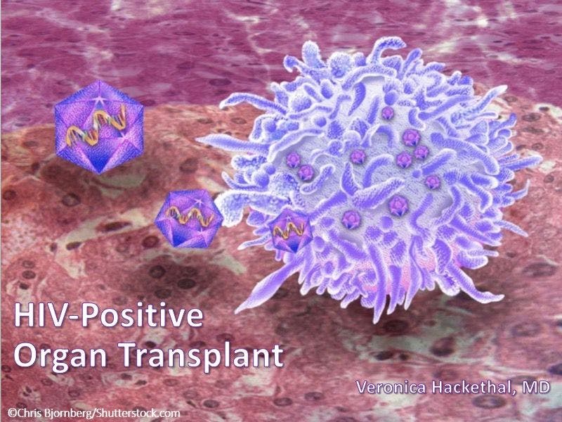 HIV-Positive Organ Transplant
