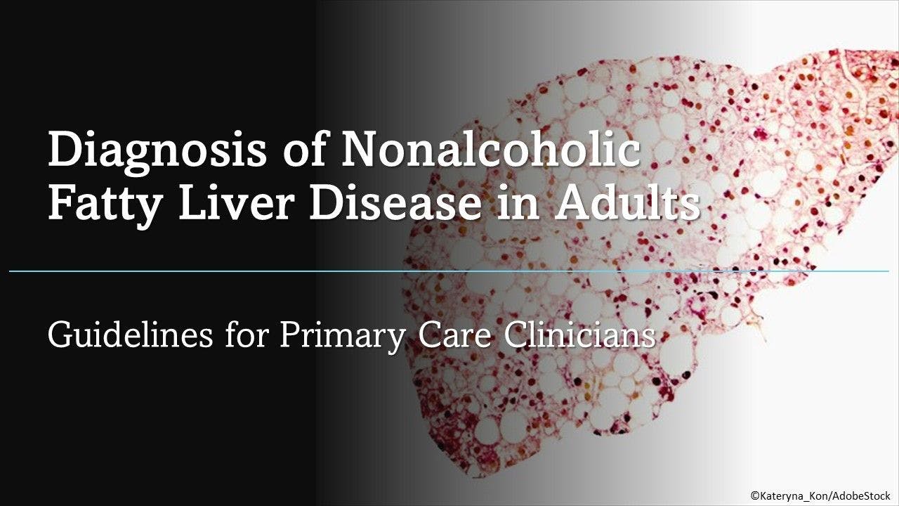 Diagnosis of Nonalcoholic Fatty Liver Disease in Adults: Guidelines for Primary Care