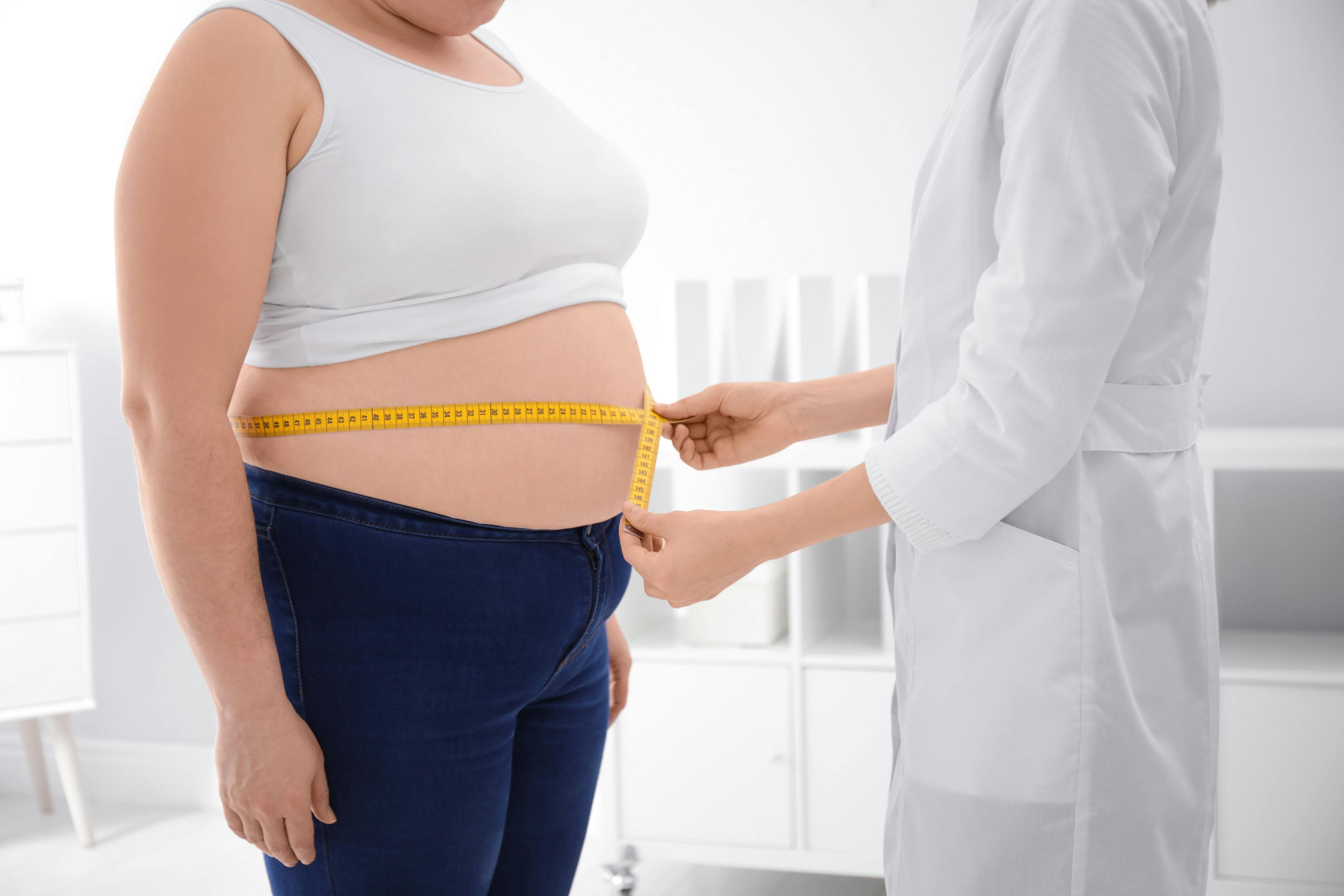 Obesity Overview: 7 Questions on the Latest Research