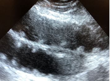 Bedside ultrasound