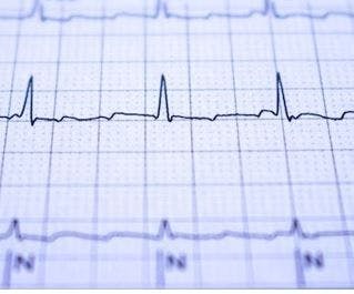 Updated Guidelines for Atrial Fibrillation from ACC/AHA Focus on Aggressive Prevention and Control and a Continuum of Care / image credit AF ecg  ©Horacio Selva/stock.adobe.com