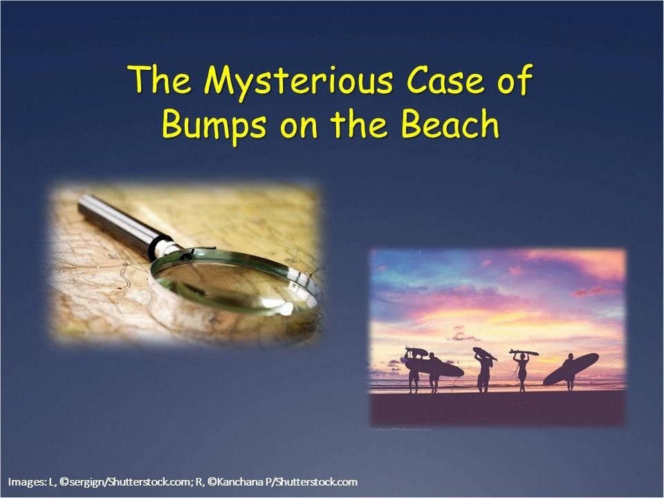 A Mysterious Case of Bumps on the Beach 