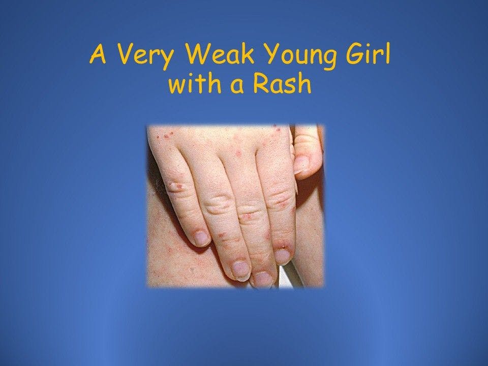 A Very Weak Young Girl with a Rash 