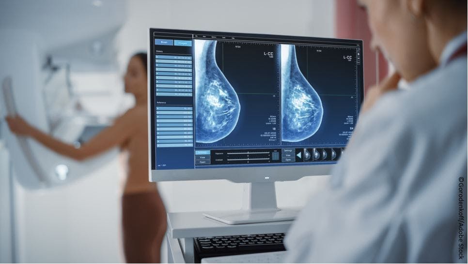 USPSTF: Begin Breast Cancer Screening at Age 40 (Not 50) Years for All Women Mammography ©Gorodenkoff/Adobe Stock