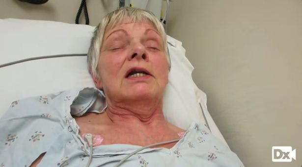 Facial Droop and Weakness in a 69-year-old Woman 