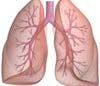 COPD: 5 Things Every Primary Care Physician Needs to Know