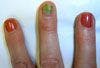 Green Fingernail? Not Your Average Manicure