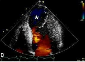 Matters of the Heart: A Cardiovascular Photo Quiz