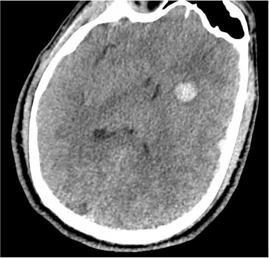 (CT of patient's head obtained in emergency department)