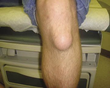 A Knee to Know: A Photo Quiz