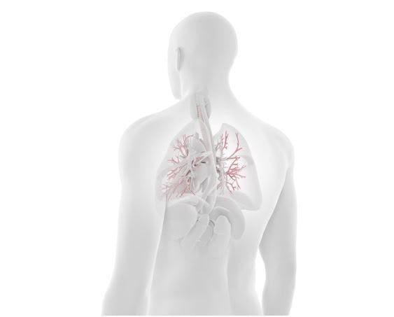 Cystic fibrosis survival increases, comorbidities more complex 
