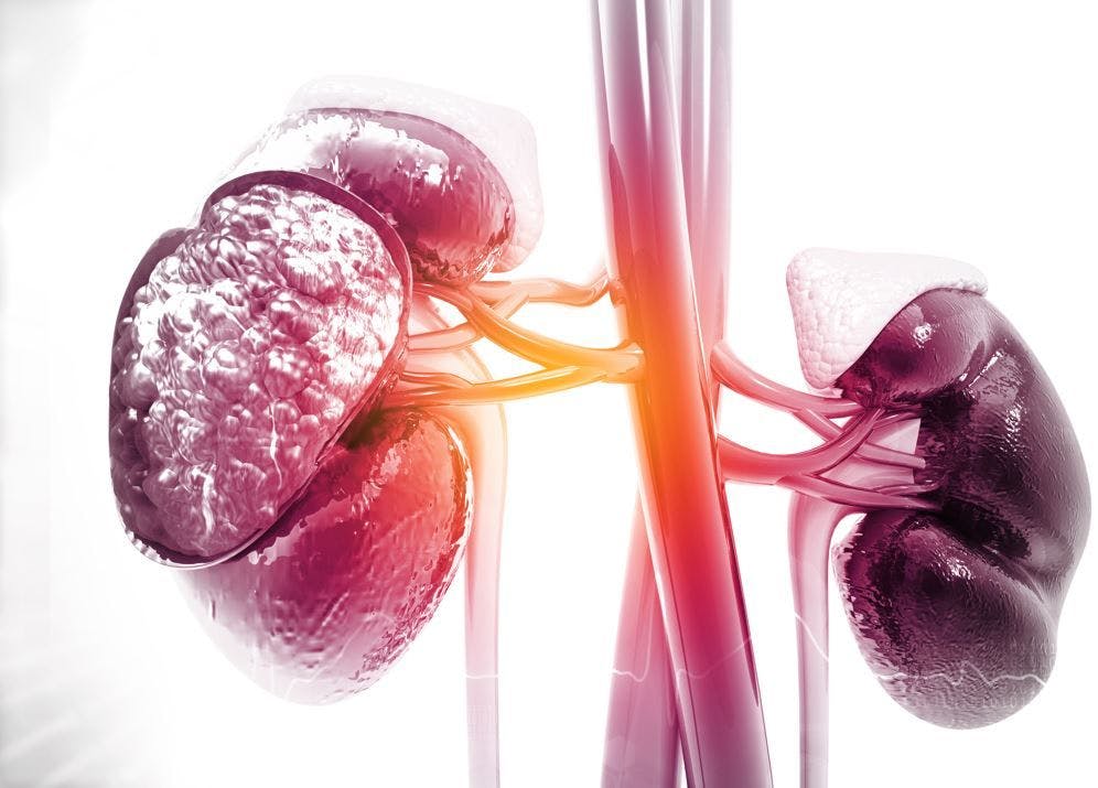 Semaglutide Reduces CKD-Related Events by 24% in Population with T2D and CKD: FLOW Findings Announced / image credit, kidney disease progression: ©Rasi/stock.adobe.com
