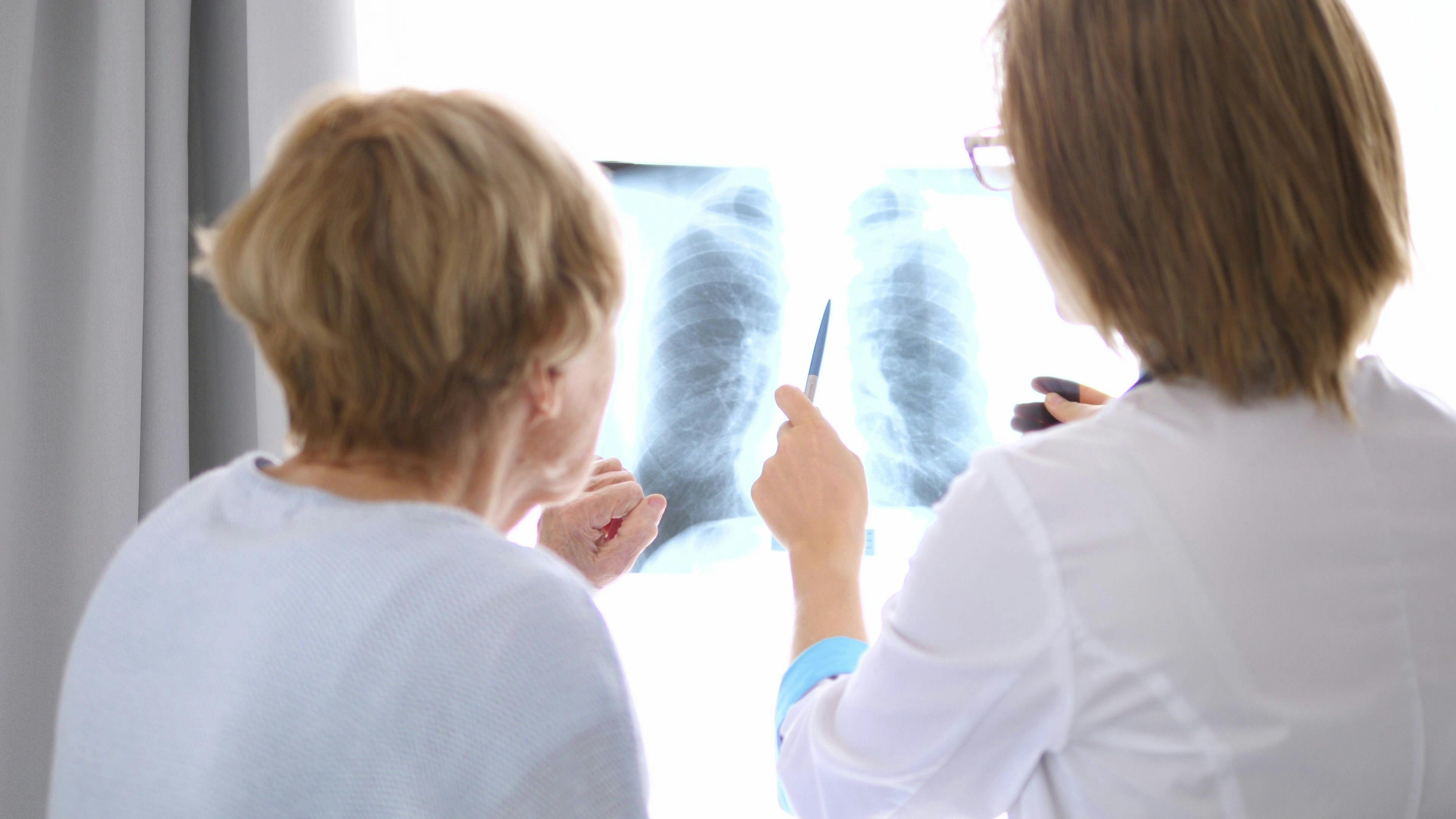 USPSTF: New Lung Cancer Screening Recommendations Will Double Number of Eligible Patients