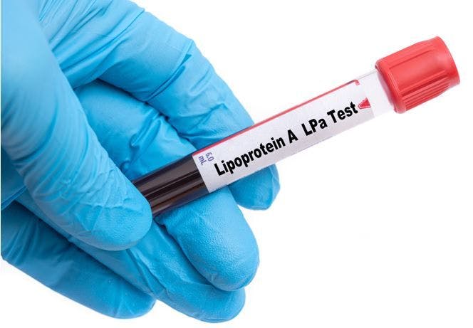 Elevated Lp(a) Levels Found Independent Predictors of Recurrent CHD in Australian Cohort blood test ©luchschenF/Adobe Stock