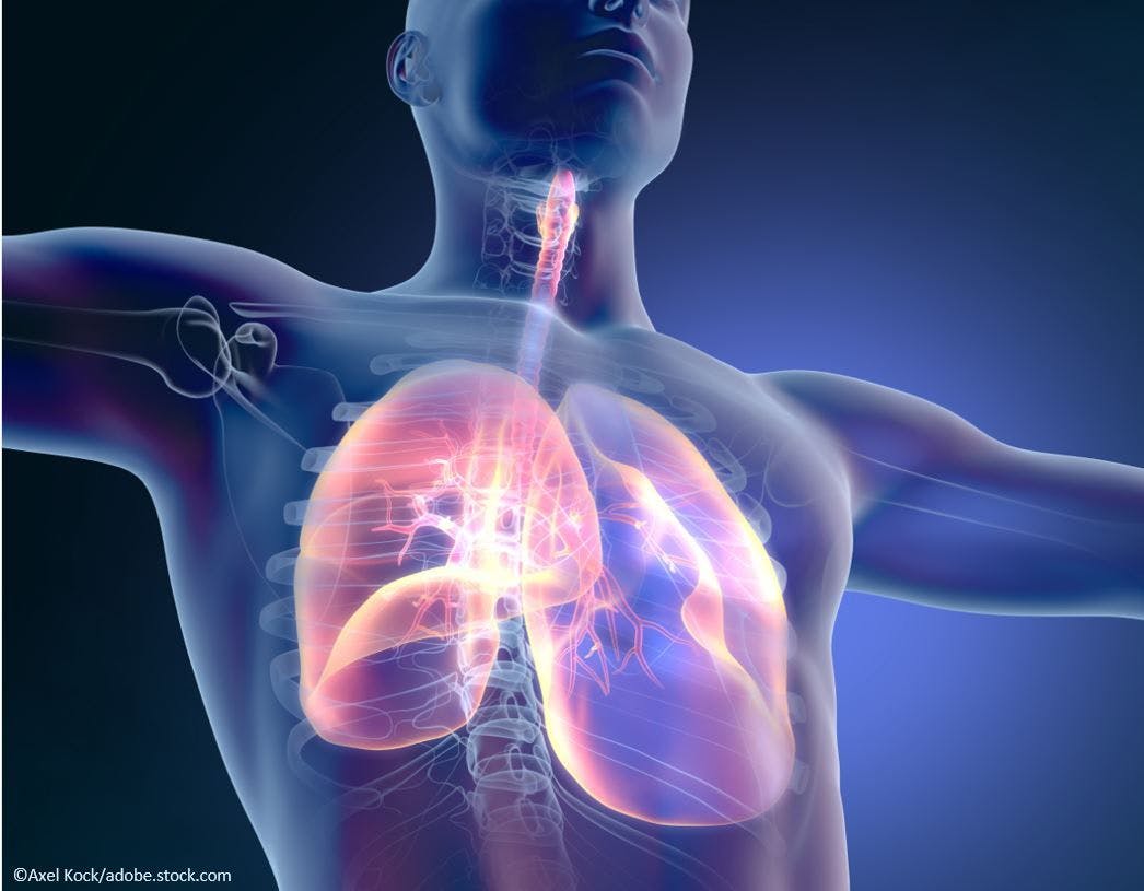 Study: GLP-1 Receptor Agonist Therapy Reduces Asthma Exacerbations in Adults with Asthma, T2D