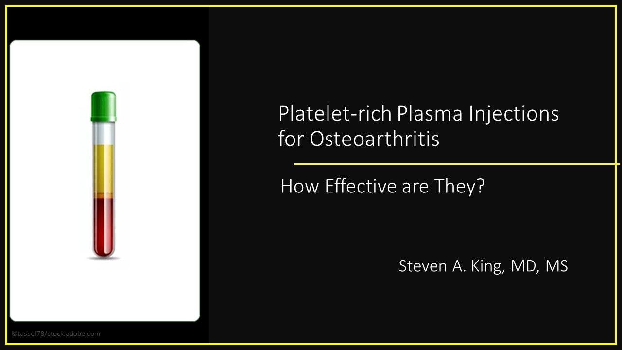 Platelet-rich Plasma Injections for Osteoarthritis: How Effective Are They? 