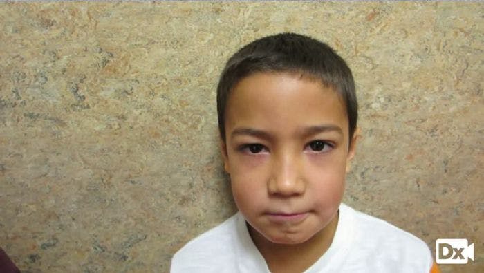 An 8-year-old Boy with Acute Facial Swelling 