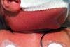 Infant in Shock With Respiratory Failure